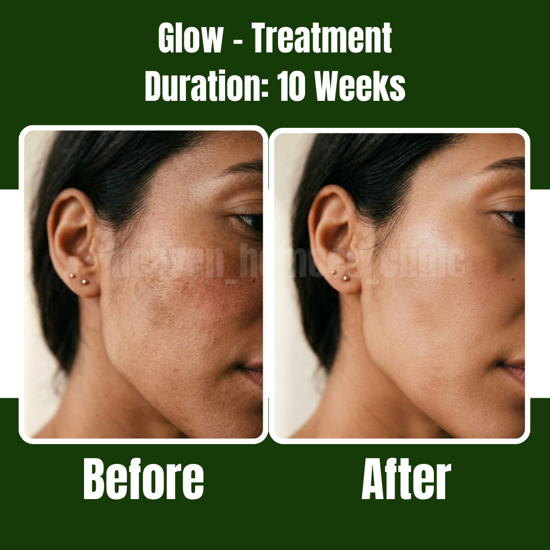 Glow Treatment patient result
